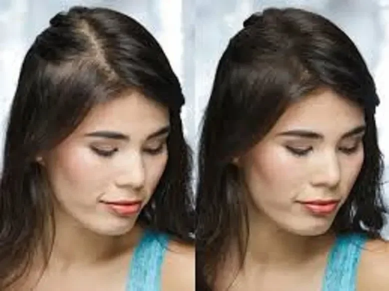 Hairstim : Kde koupit v České republice?