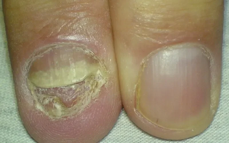 Skinatrin : složení pouze přírodní složky.